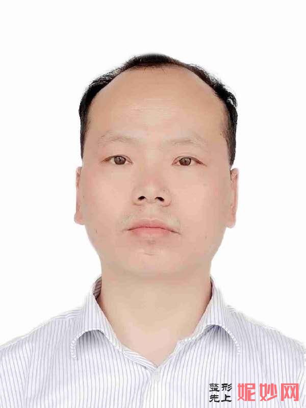 仙桃柏乐医疗美容诊所王建平做全切双眼皮怎么样？附医生简介|全切双眼皮案例及价格表