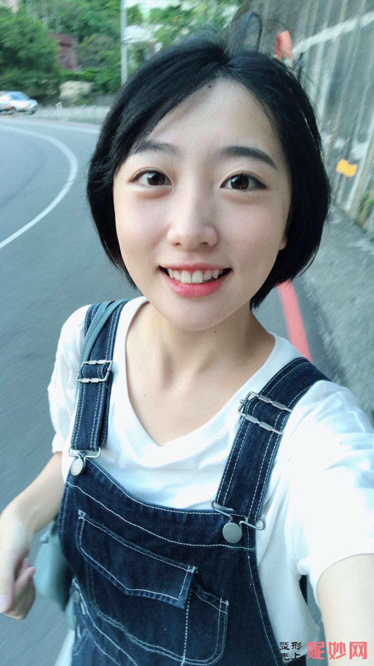 郑州华领医疗美容医院简介,附上发际线种植收费表及案例