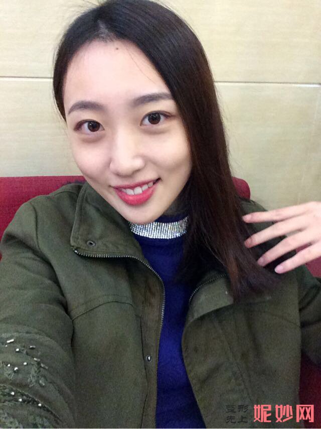 郑州华领医疗美容医院简介,附上发际线种植收费表及案例
