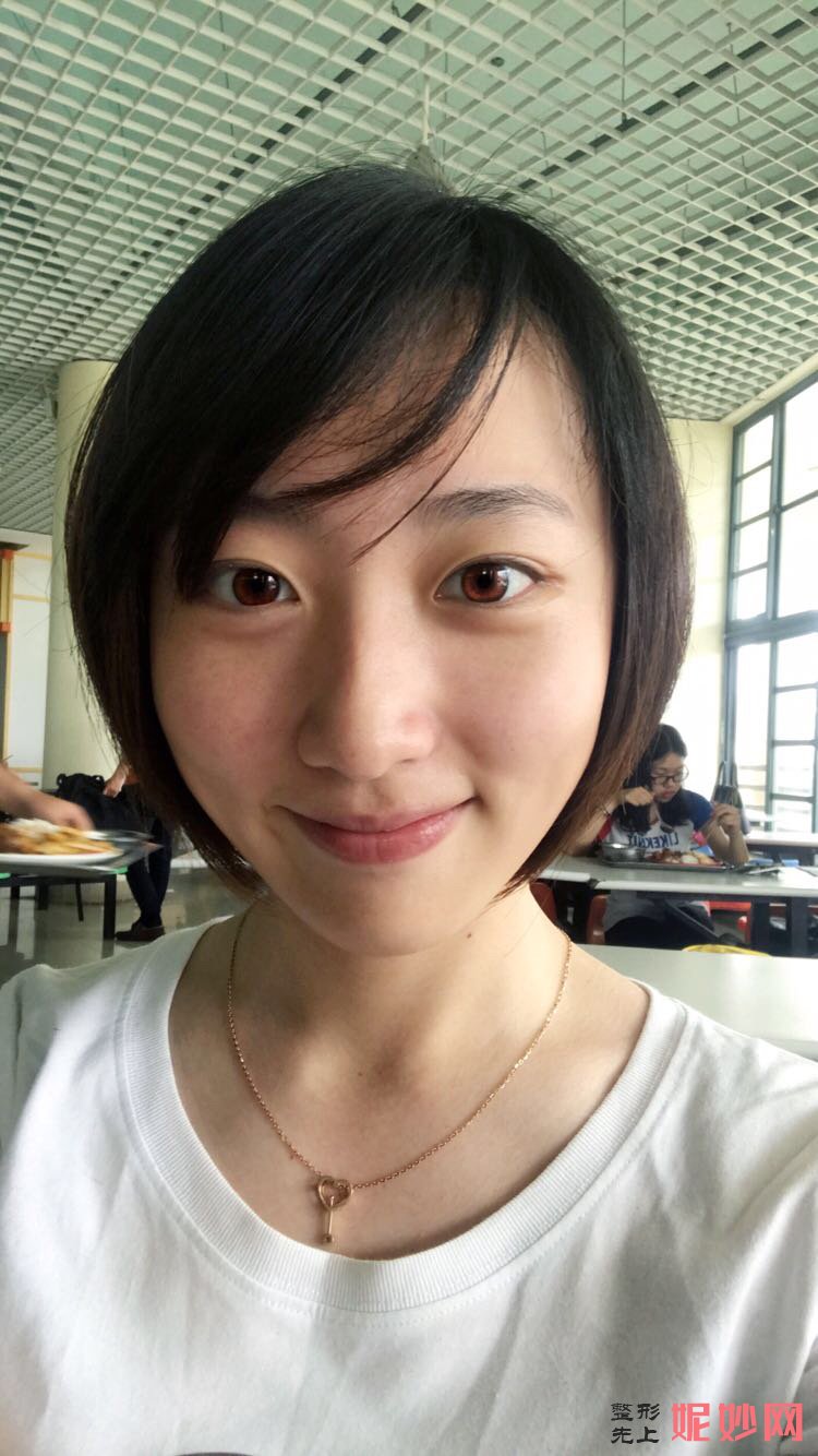 郑州华领医疗美容医院简介,附上发际线种植收费表及案例
