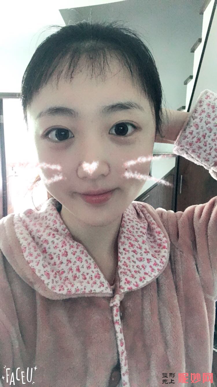 郑州华领医疗美容医院简介,附上发际线种植收费表及案例