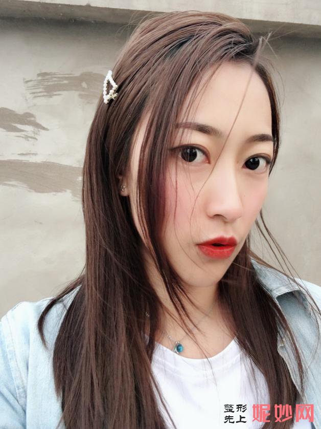 郑州壹加壹医疗美容医院口碑怎么样，附发际线种植案例_价格表