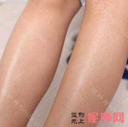 北京八大处脱毛专家介绍！有黄绿萍、陈迎涛、张玲等医生,还有案例和价格哦