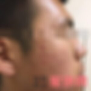上海伊莱美医疗美容医院做红蓝光美肤好吗？附2022红蓝光美肤价格表