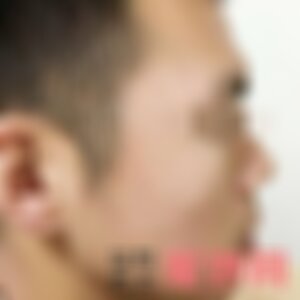 云南华美美莱美容医院怎么样？