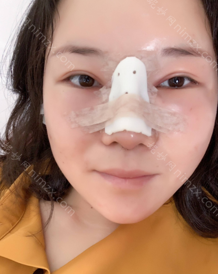 贵阳较出名的隆鼻医生排名：这些医生做隆鼻手术都是比较好的，看隆鼻案例就可以看出来
