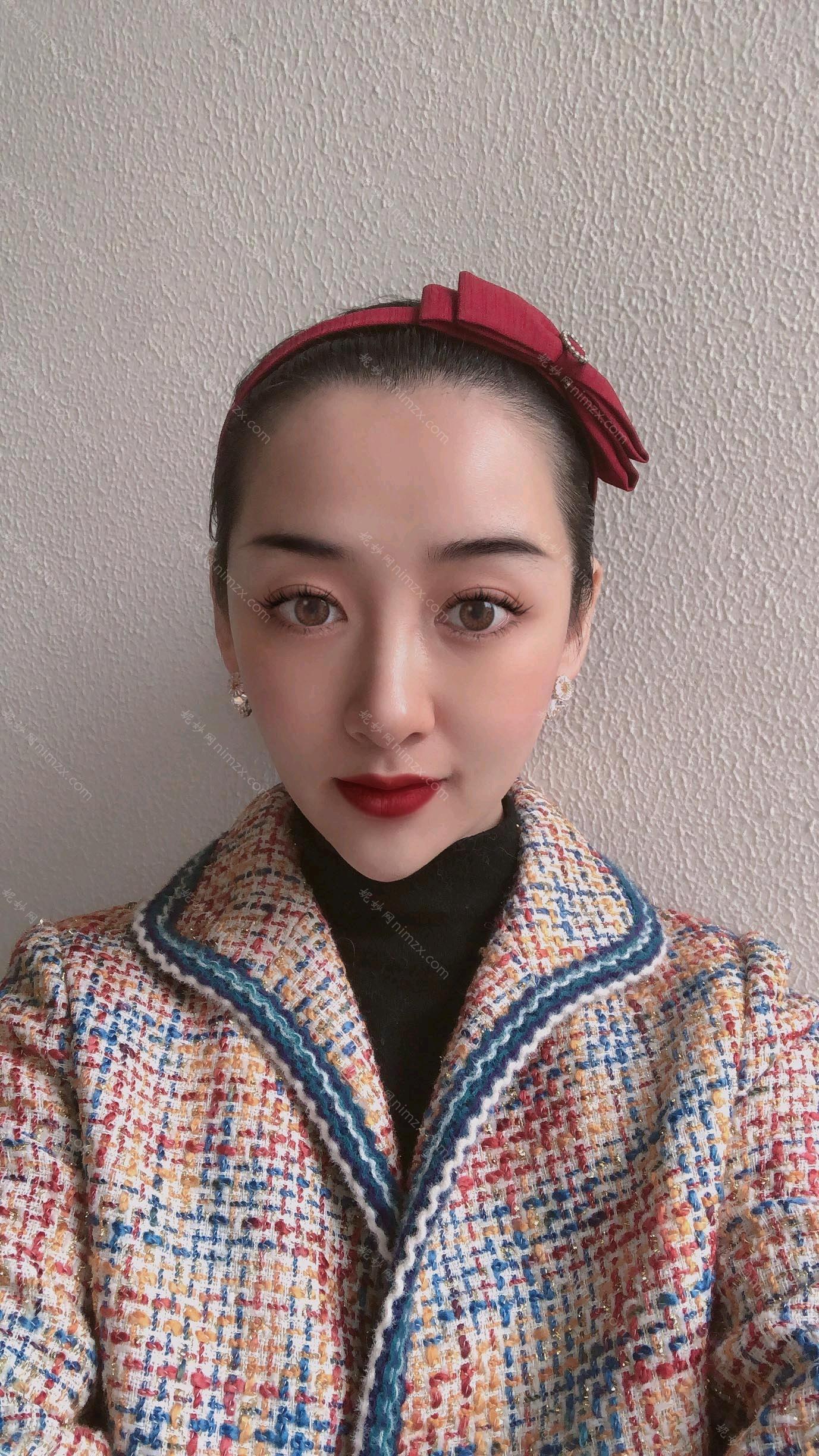 天津华中医疗美容医院做面部提升做的好吗?面部提升案例分享