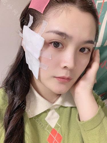 北京航空医院能洗眼线吗?做整形怎么样?想去北京航空医院做整形，有案例可以参考吗?