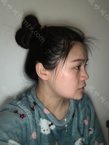 北京航空医院能洗眼线吗?做整形怎么样?想去北京航空医院做整形，有案例可以参考吗?
