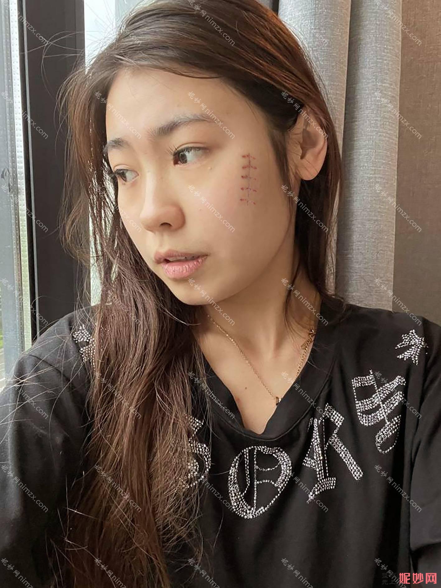 贵阳中医院皮肤病医院怎么样？是不是三甲医院？