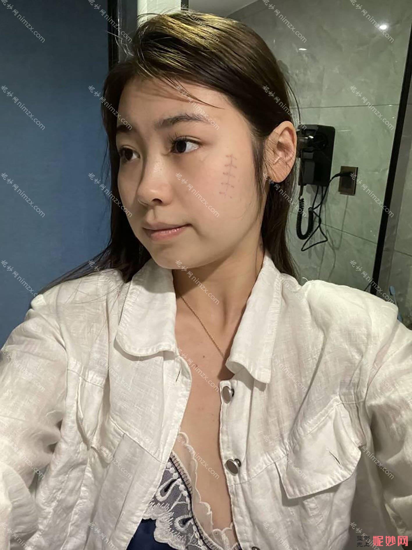 贵阳中医院皮肤病医院怎么样？是不是三甲医院？