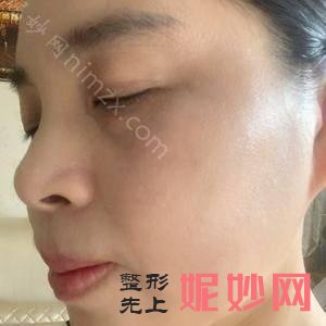 皮秒激光贵阳中医院皮肤病医院怎么样？做了之后效果好吗？