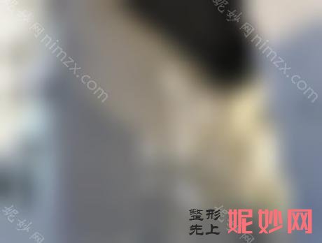 南京哪家医院吸脂，前十名单更新案例效果和价格表公示