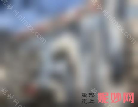 南京热玛吉整形医院排名前十，南京苏王、贝思、南京连天美等一一盘点前十案例和价格出炉