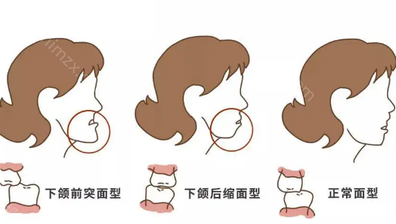 分享一张正常牙齿咬合图，教你判断自己的牙齿是否需要矫正