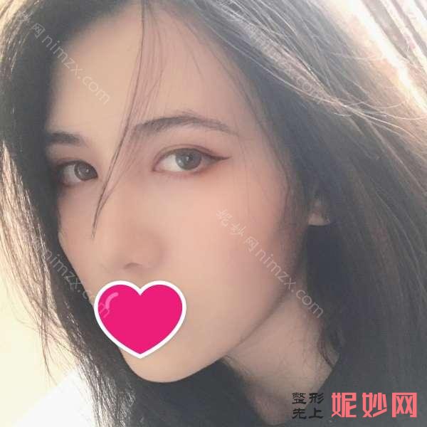 八大处杨欣整容多少钱?案例反馈_收费标准