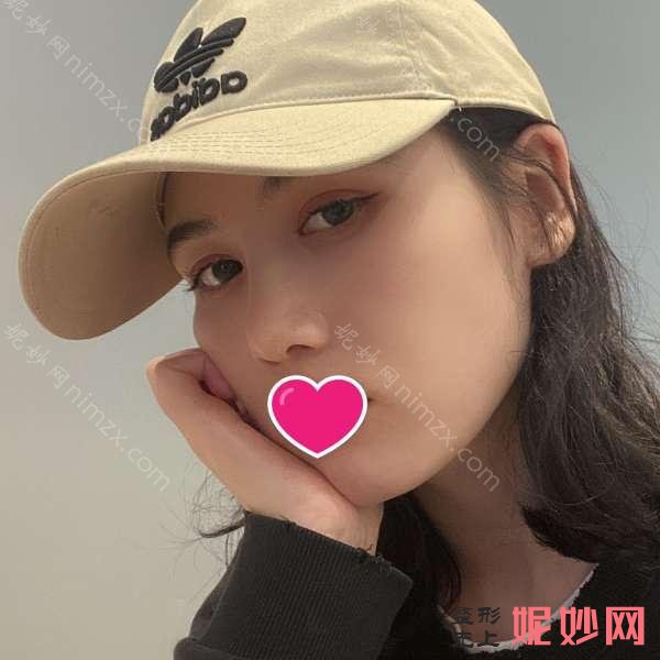 八大处杨欣整容多少钱?案例反馈_收费标准