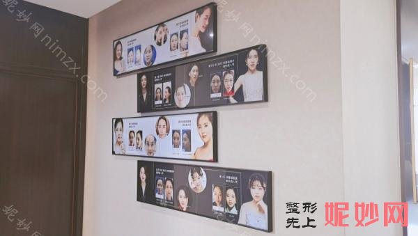 无锡有哪些整形医院有热玛吉!半岛、施尔美等汇总热玛吉案例揭晓