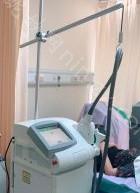 深圳北大李天石做鼻子怎么样?三个月_价格表更新
