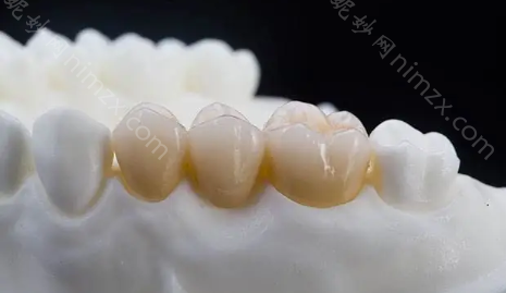 拿到宁波康铭口腔的全瓷牙价格表,做完根管治疗的要收藏