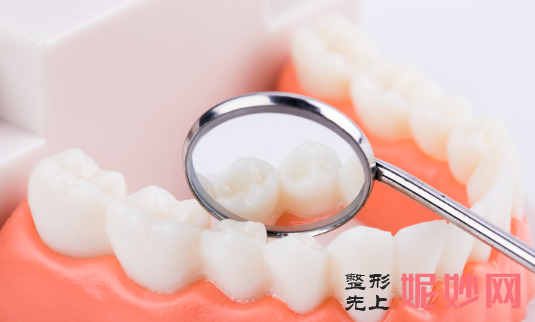 搭桥和种牙哪个好？种牙注意事项要了解