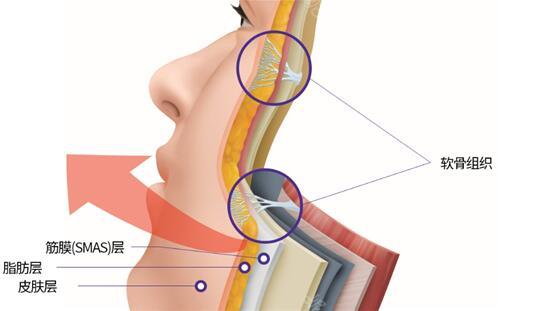 广州曙光热玛吉是真的，而且技术好收费合理