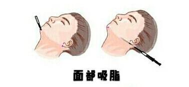 西安艺星医疗美容医院技术怎么样？医生资质、整形案例全方位解析