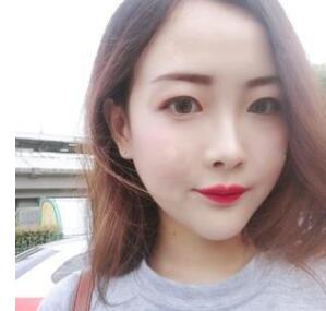 怕磨骨手术失败 找的上海九院磨骨专家梁平做