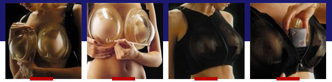武汉爱思特 迈阿密非手术乳房再造术 效果逼真