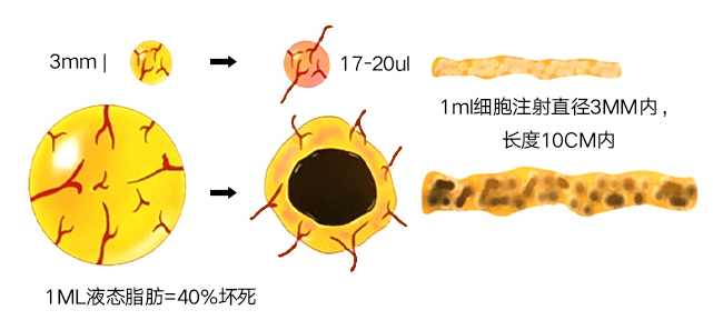 武汉爱思特 迈阿密非手术乳房再造术 效果逼真