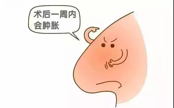重庆华美是正规的吗?重庆华美整形医院隆鼻方案全过程