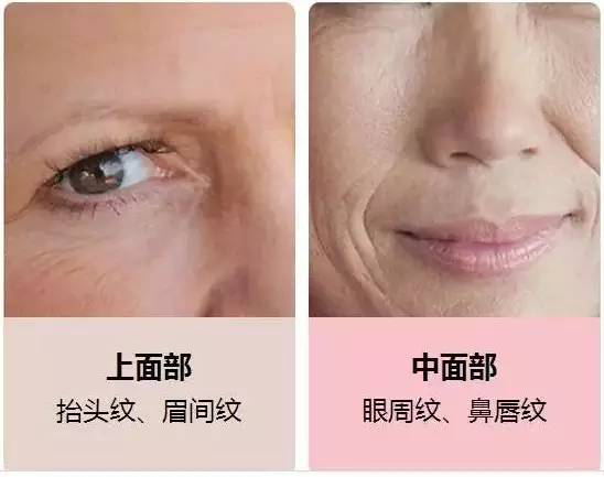 在西安美立方整形医院做面部埋线提升后悔死了?揭秘西安美立方