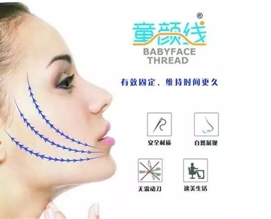 除皱黑科技—童颜线，正式进驻上海伊莱美整形医院