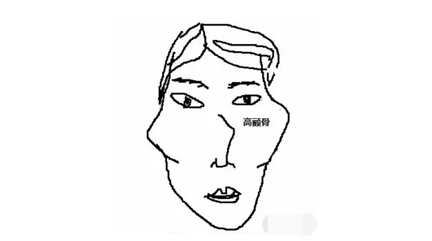 深圳广美整形王天国医生：其实99%的人都不懂颧骨缩小和磨骨的