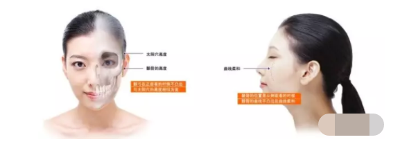 深圳广美整形王天国医生：其实99%的人都不懂颧骨缩小和磨骨的