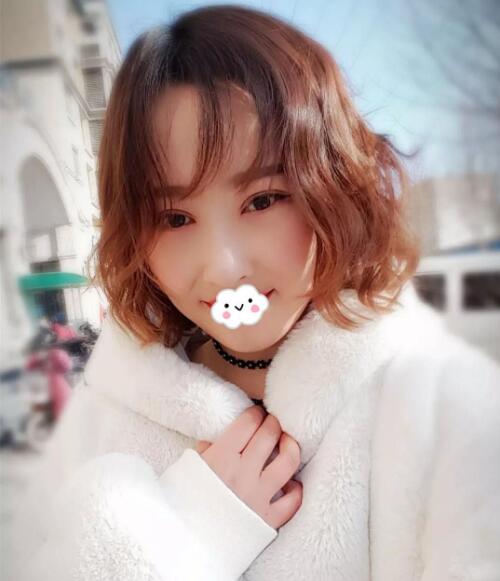 石家庄美联臣翟彦刚医生做双眼皮怎么样?多少钱?附案例效果