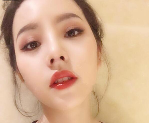 贵阳应超小李飞刀大吴是谁?吴光宇整形技术_风格_效果图价格