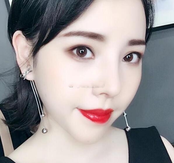 贵阳应超小李飞刀大吴是谁?吴光宇整形技术_风格_效果图价格