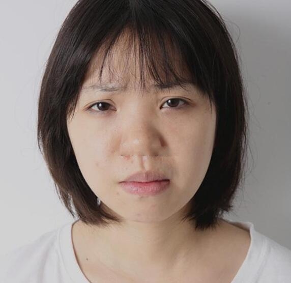 贵阳应超小李飞刀大吴是谁?吴光宇整形技术_风格_效果图价格