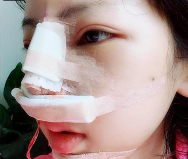 贵阳应超小李飞刀大吴是谁?吴光宇整形技术_风格_效果图价格
