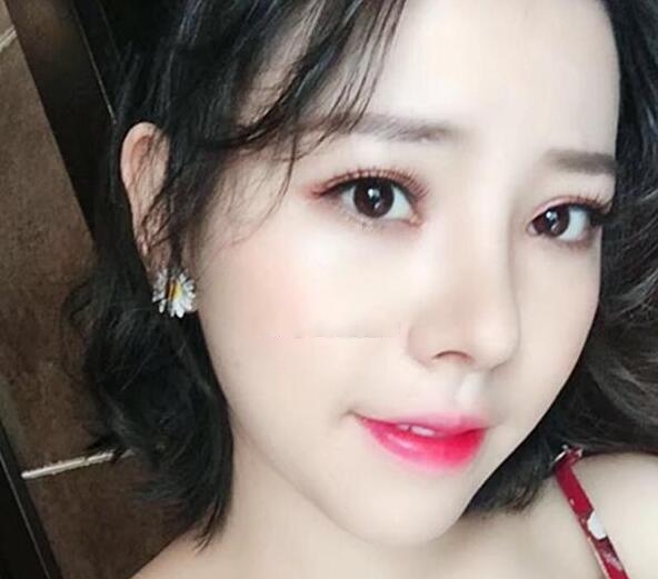 贵阳应超小李飞刀大吴是谁?吴光宇整形技术_风格_效果图价格