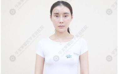 成都华美谷斌整形技术怎么样?谷斌隆胸、修复双眼皮案例及价格