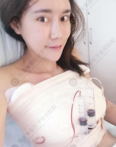 成都华美谷斌整形技术怎么样?谷斌隆胸、修复双眼皮案例及价格