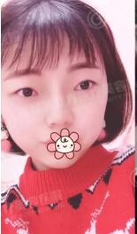 成都美立方李瑞萱院长怎么样?李瑞萱整形技术_案例效果图_价格