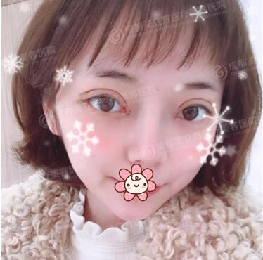 成都美立方李瑞萱院长怎么样?李瑞萱整形技术_案例效果图_价格