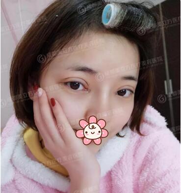 成都美立方李瑞萱院长怎么样?李瑞萱整形技术_案例效果图_价格