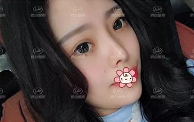 成都娇点李竞医生擅长什么?李竞整形技术_手术风格_效果_价格