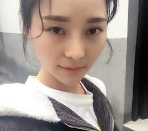 成都蓉城周鼻子怎么样?周仪鼻整形案例效果图及手术风格_价格