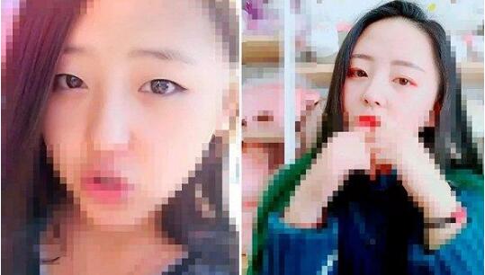 杭州億美医疗美容医院怎么样?億美医生整形案例效果图_价格表
