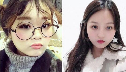 杭州億美医疗美容医院怎么样?億美医生整形案例效果图_价格表